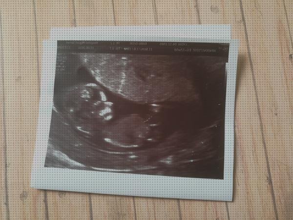 ¿Dónde poder comprar Mas ecografía 12 semanas niño niña ecografía once semanas ecografía 12 semanas seguridad social?