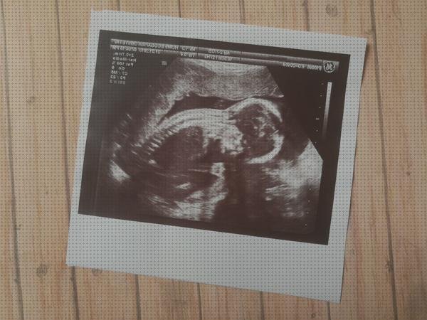 Las mejores Mas ecografía 12 semanas niño niña ecografía once semanas ecografía 12 semanas seguridad social