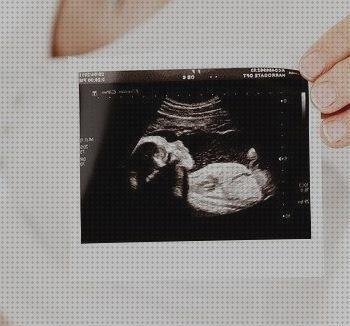 Review de ecografía 12 semanas seguridad social