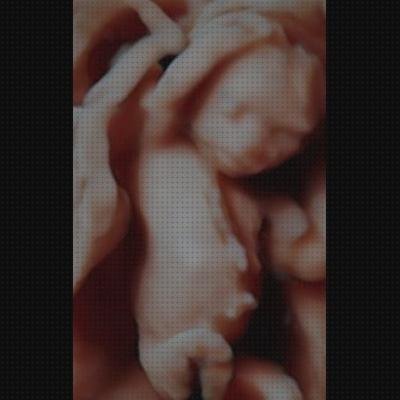 Análisis de las 8 mejores Ecografías 14 Semanas 5d