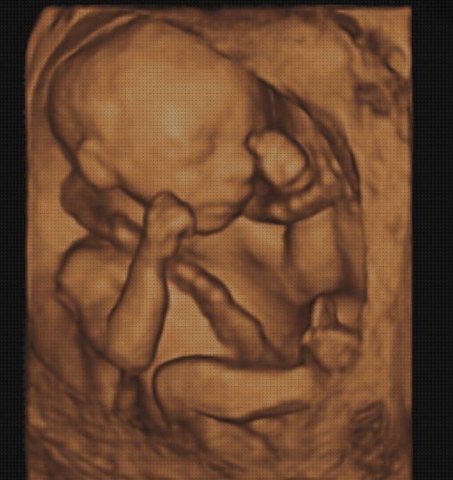 Las mejores ecografía 20 semanas niña ecografía once semanas ecografía 20 semanas 3e