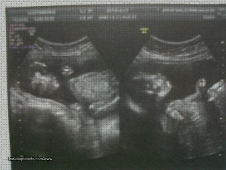 Opiniones de las 8 mejores Ecografías 21 Semanas Diabetes Gestacional