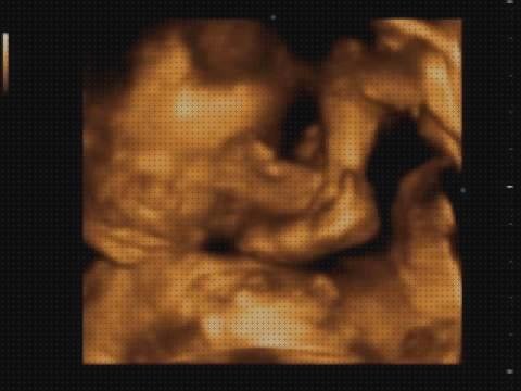 Las mejores 6 Ecografías 27 Semanas 5d De Un Para Niños Varones