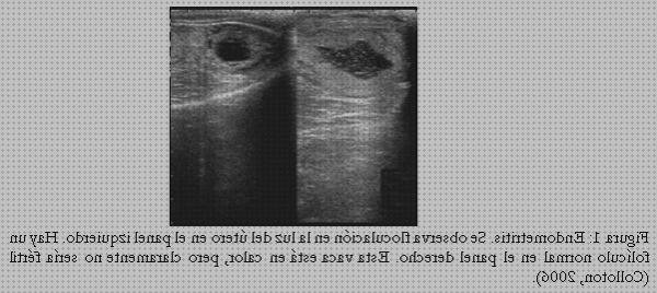 Opiniones de Mas ecografía segundo trimestre embarazo Mas ecografía cabeza grande Mas ecografía coneja ecografía 28 días baca lechera