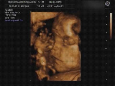 Las mejores marcas de ecografía once semanas ecografía 28 semanas niña