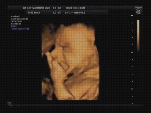 Review de ecografía 28 semanas niña