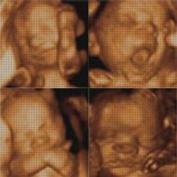 ¿Dónde poder comprar tensiometro niños ecografía 3 d niños?