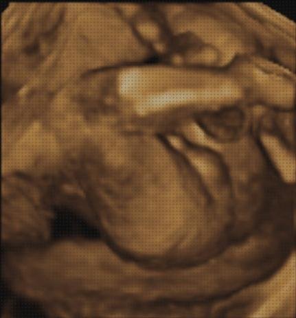 Las mejores marcas de tensiometro niños ecografía 3 d niños