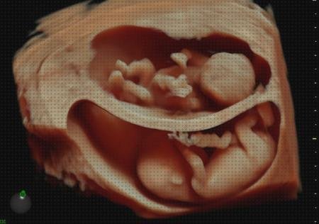 Las mejores tensiometro niños ecografía 3 d niños