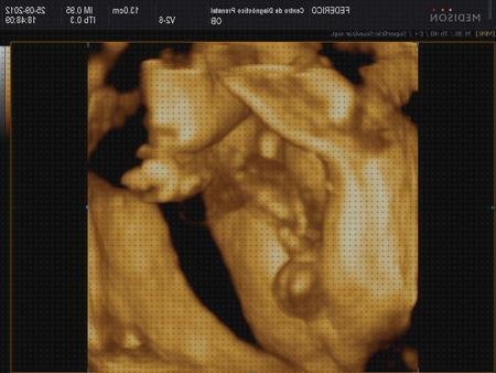 Análisis de las 12 mejores Ecografías 3 D Para Niños