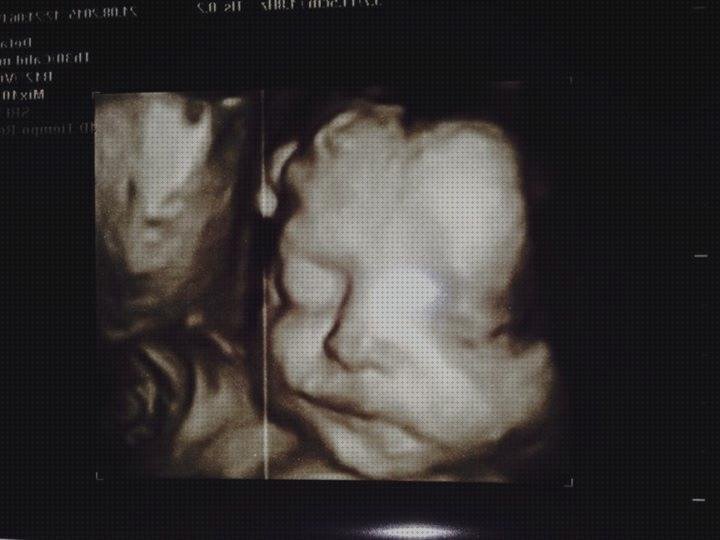 Review de ecografía 31 semanas