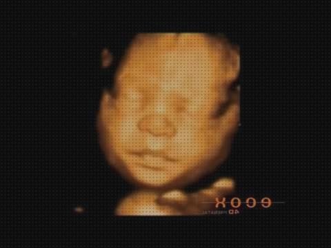 Opiniones de ecografía once semanas ecografía 31 semanas