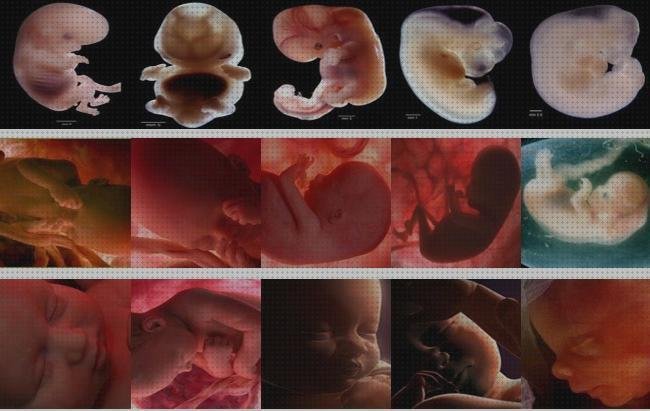 Opiniones de ecografía once semanas ecografía 33 semanas bebe vejiga llena