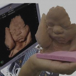 ¿Dónde poder comprar tensiometro brazo ofertas Mas espirómetros tipos Mas apósit esteril ecografía 3d ofertas?