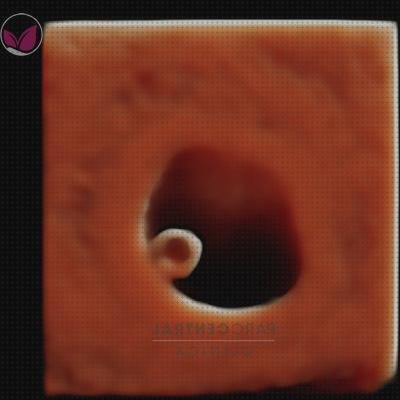 Las mejores ecografía once semanas ecografía 4 semanas 5d