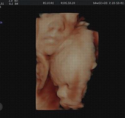 Review de ecografía 4 semanas 5d