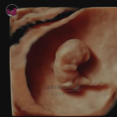 Opiniones de ecografía once semanas ecografía 4 semanas 5d