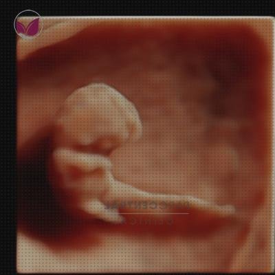 Las 9 Mejores Ecografías 4 Semanas 5d