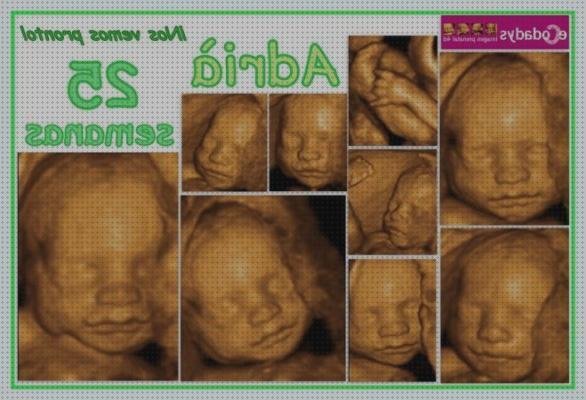 ¿Dónde poder comprar ecografía ecodadys 26 semanas ecografía once semanas ecografía 4d ecodadys con 28 semanas?