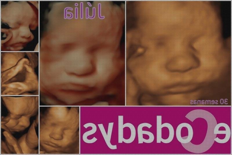 Las 14 Mejores Ecografías 4d Ecodadys Con 28 Semanas