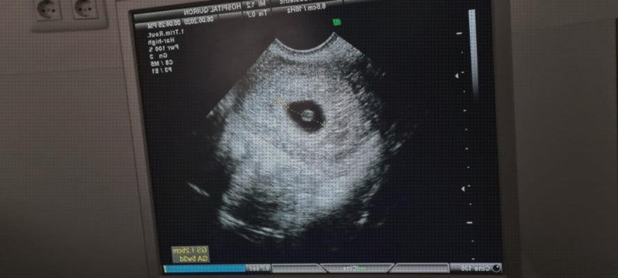 ¿Dónde poder comprar ecografía once semanas ecografía 5 semanas hospital?