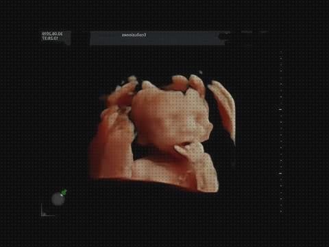 ¿Dónde poder comprar ecografía 4 semanas 5d ecografía once semanas ecografía 5d 21 semanas?