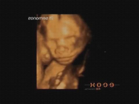 Review de ecografía 5d 21 semanas