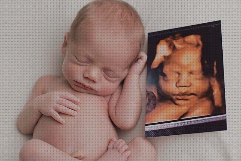 ¿Dónde poder comprar ecografía 4 semanas 5d ecografía once semanas ecografía 5d de 30 semanas un niño?