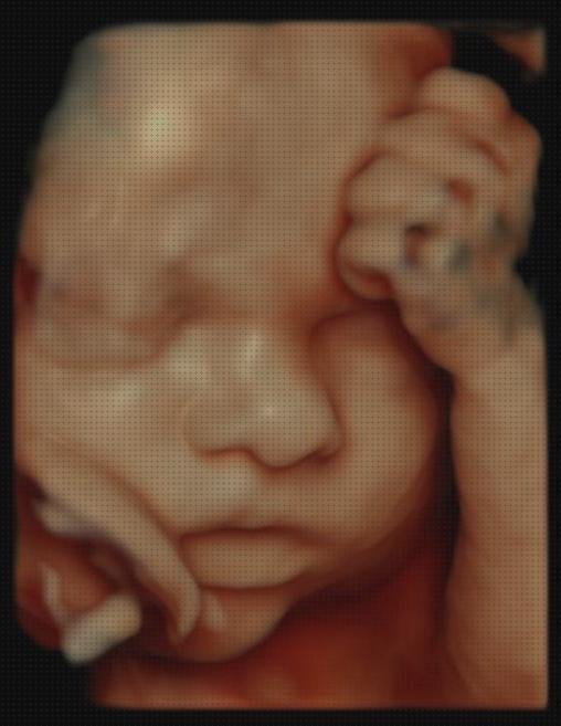 Las mejores ecografía 4 semanas 5d ecografía once semanas ecografía 5d de 30 semanas un niño