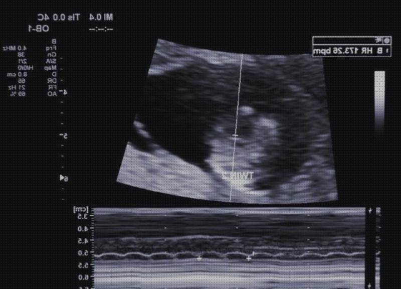 Las mejores semanas ecografía 6 semanas de embarazo corazon