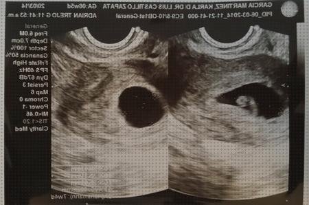 Review de ecografía 6 semanas de embarazo corazon
