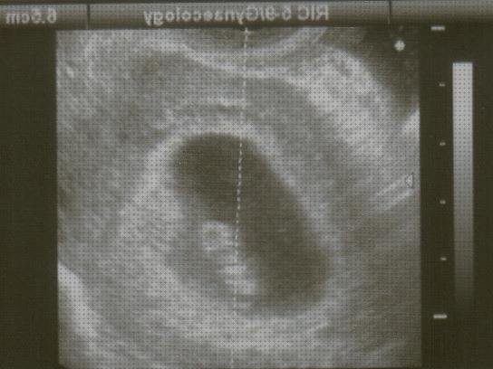 Las mejores marcas de ecografía once semanas ecografía 7 semanas y media