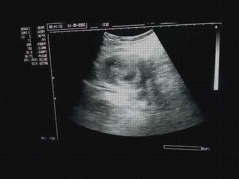 Review de ecografía 7 semanas y media