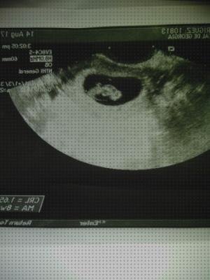 Review de ecografía 8 semanas niña