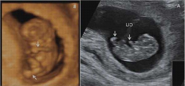 Análisis de las 11 mejores Ecografías 9 Meses 3d