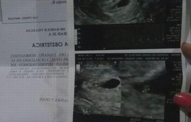 Las mejores ecografía 3 semanas embarazo ecografía once semanas ecografía 9 semanas embarazo sin latido