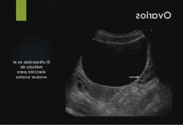 ¿Dónde poder comprar vesical ecografía a tero vesical?