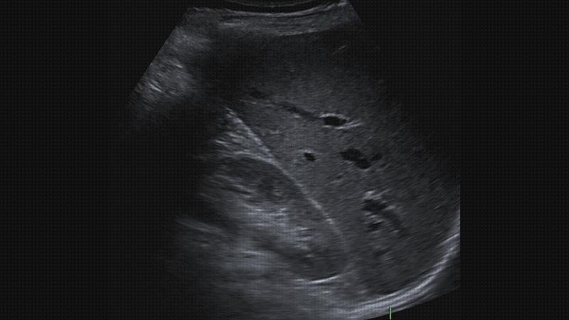 Las mejores ecografías ecografía abdominal