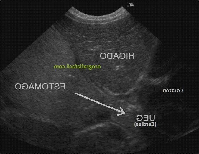 Opiniones de las 7 mejores Ecografías Abdominales Estomagos