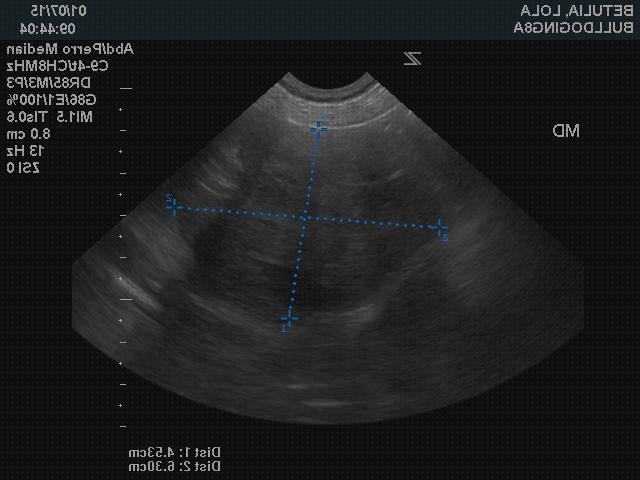 Las mejores marcas de ecografía abdominal ecografías ecografía abdominal masa