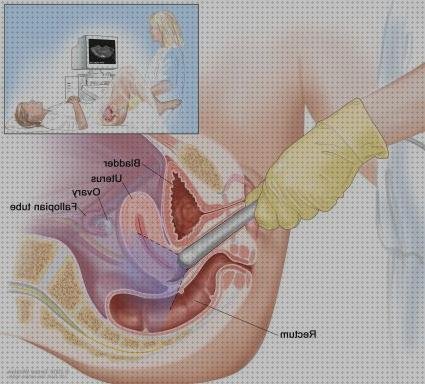 Review de ecografía abdominal pelvica