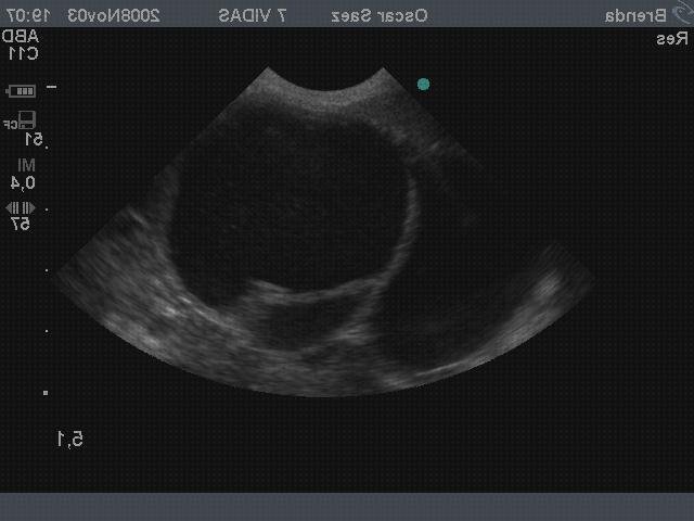 Las mejores piometra ecografía abdominal piometra perra