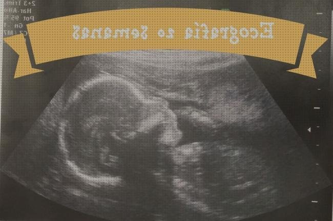 Review de ecografía abdominal seguridad social