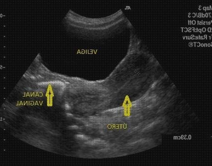 Opiniones de las 12 mejores Ecografías Abdominales Utero