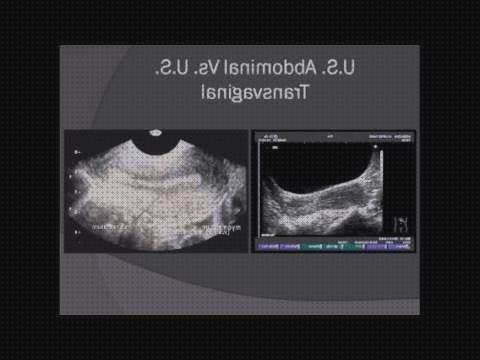 ¿Dónde poder comprar ecografía abdominal ecografías ecografía abdominal y vaginal?