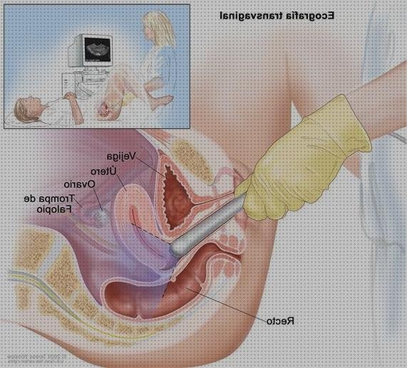 Las mejores marcas de ecografía abdominal ecografías ecografía abdominal y vaginal