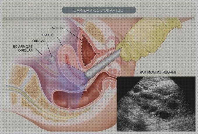 Las mejores ecografía abdominal ecografías ecografía abdominal y vaginal