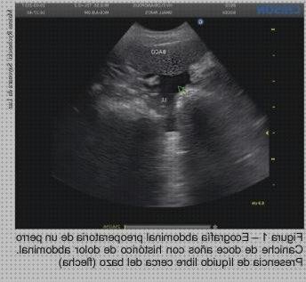 ¿Dónde poder comprar ecografía abdominal ecografías ecografía abdominal y vejiga?