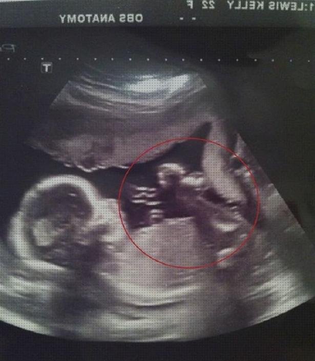 Las mejores marcas de Mas ecografía segundo trimestre embarazo Mas ecografía cabeza grande Mas ecografía coneja ecografía ángel de la guarda