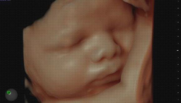 ¿Dónde poder comprar ecografías bebe ecografías ecografía bebe con móvil?